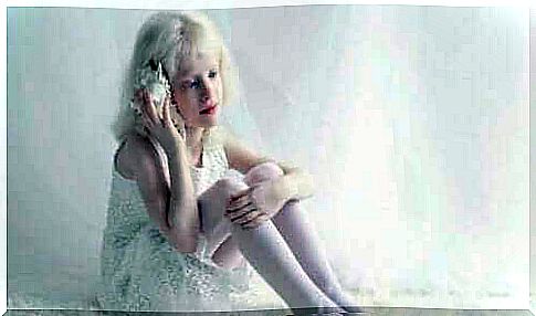 Little girl who has to live with albinism