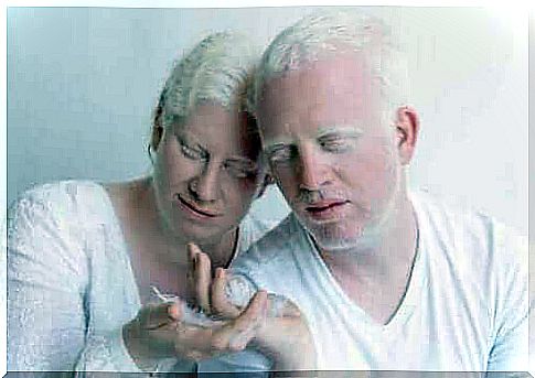 Couples living with albinism