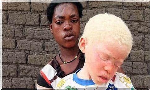 Black mother with albino children